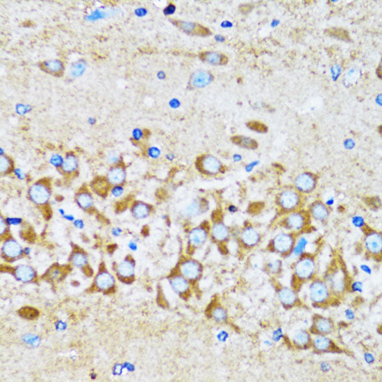 Arp2 Rabbit pAb