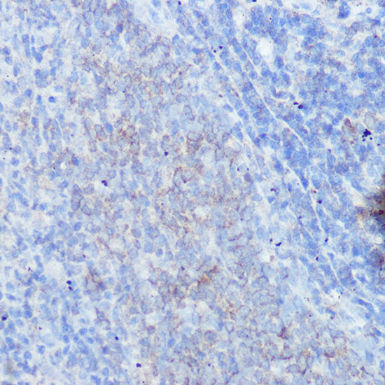 IFNGR1 Rabbit pAb