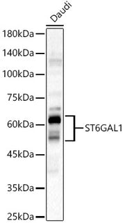 ST6GAL1 Rabbit pAb