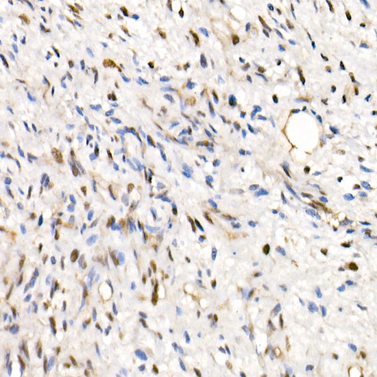 SMARCB1/SNF5 Rabbit pAb