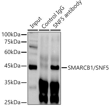 SMARCB1/SNF5 Rabbit pAb