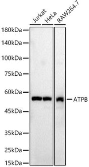ATPB Rabbit pAb