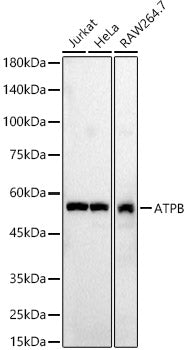 ATPB Rabbit pAb