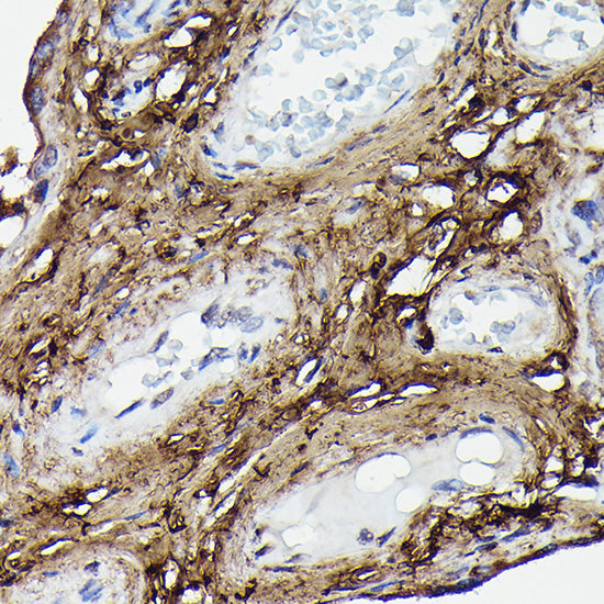 Collagen I/COL1A2 Rabbit pAb