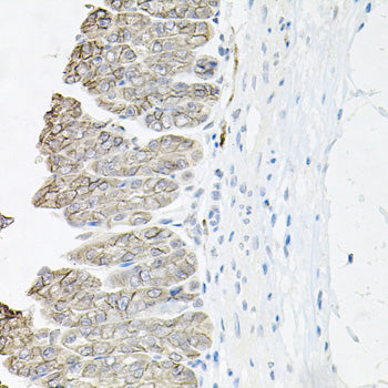 ATP1B1 Rabbit pAb