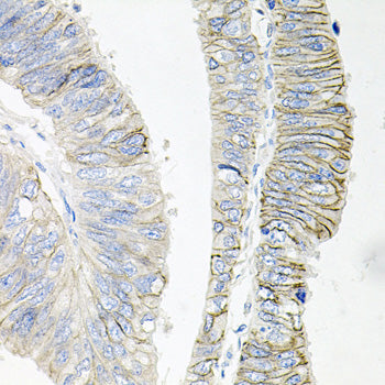 ATP1B1 Rabbit pAb