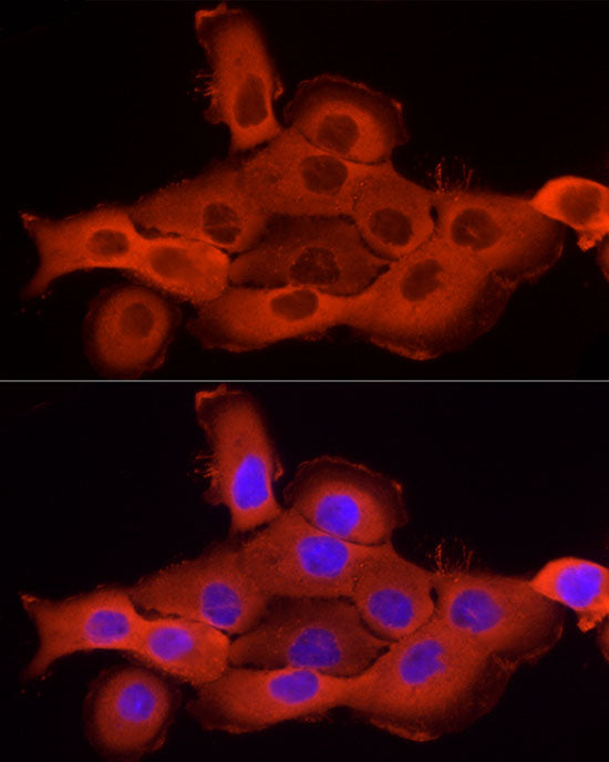 Cortactin Rabbit pAb