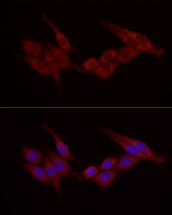 Cortactin Rabbit pAb