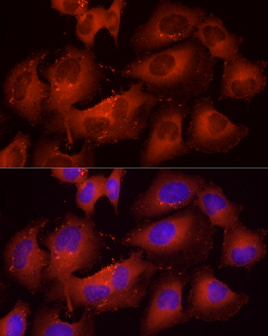 Cortactin Rabbit pAb