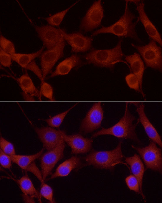 Cortactin Rabbit pAb