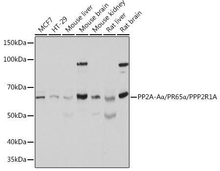 PP2A-Aα/PR65α/PPP2R1A Rabbit pAb