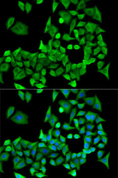 PP2A-Aα/PR65α/PPP2R1A Rabbit pAb