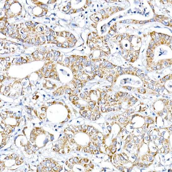 PTPIP51/RMDN3 Rabbit pAb