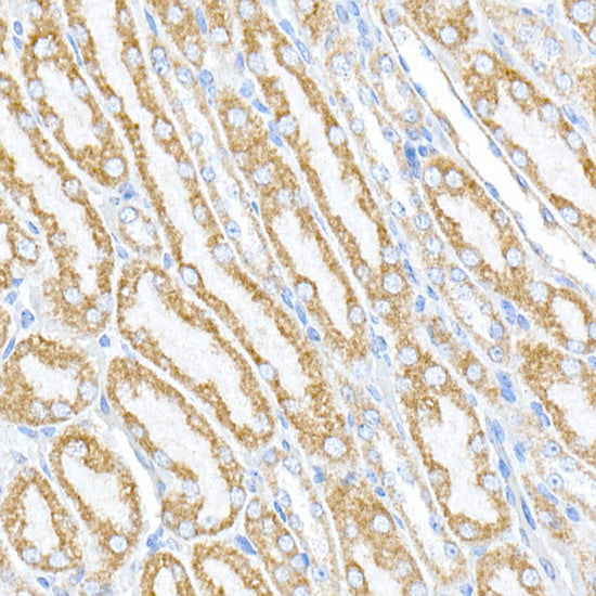 PTPIP51/RMDN3 Rabbit pAb