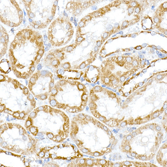 PTPIP51/RMDN3 Rabbit pAb