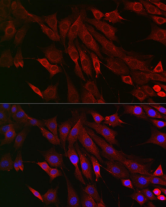 PTPIP51/RMDN3 Rabbit pAb