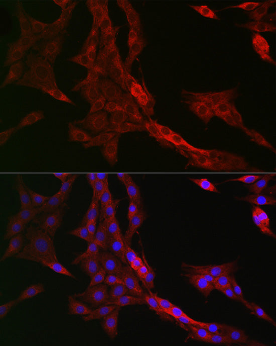 PTPIP51/RMDN3 Rabbit pAb
