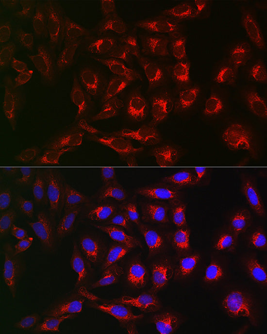 PTPIP51/RMDN3 Rabbit pAb