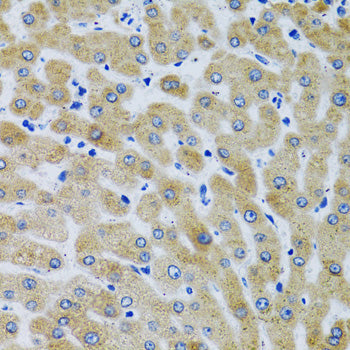 MBL2 Rabbit pAb