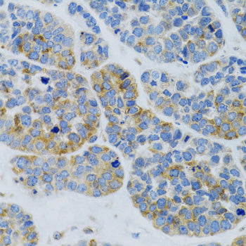 MBL2 Rabbit pAb