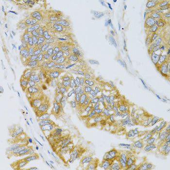 MBL2 Rabbit pAb