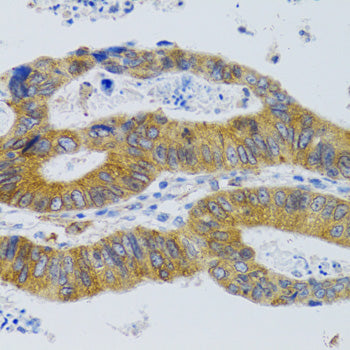 MBL2 Rabbit pAb