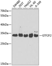 GTF2F2 Rabbit pAb