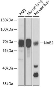 NAB2 Rabbit pAb