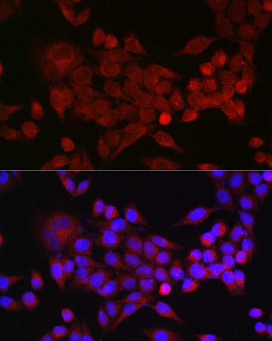 Inhibin beta A (INHBA) Rabbit pAb