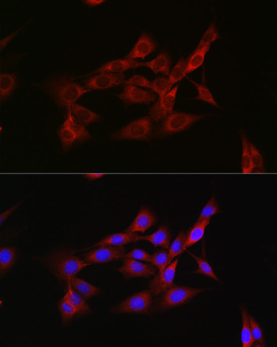 Inhibin beta A (INHBA) Rabbit pAb
