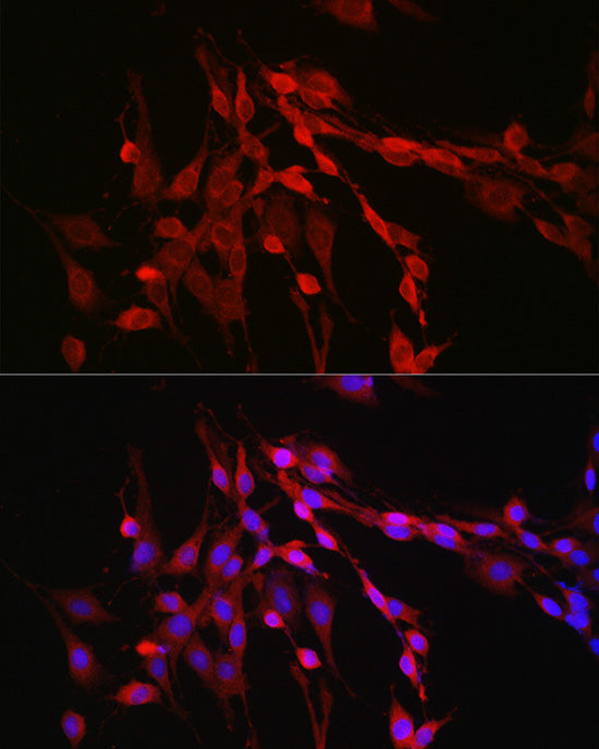 Inhibin beta A (INHBA) Rabbit pAb