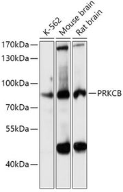 PKC-beta Rabbit pAb