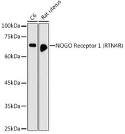 NOGO Receptor 1 (RTN4R) Rabbit pAb