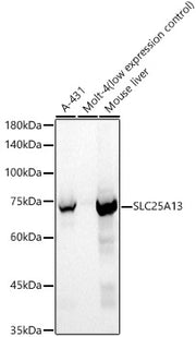 SLC25A13 Rabbit pAb