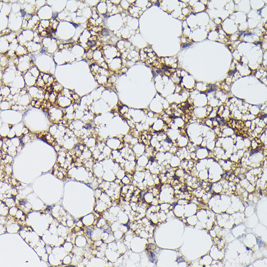 UCP1 Rabbit pAb