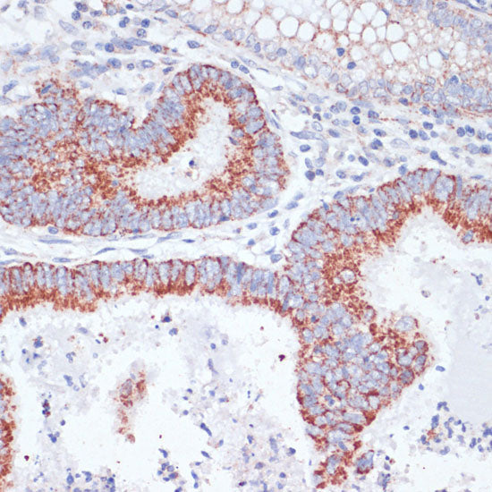 CD71/Transferrin Receptor Rabbit pAb