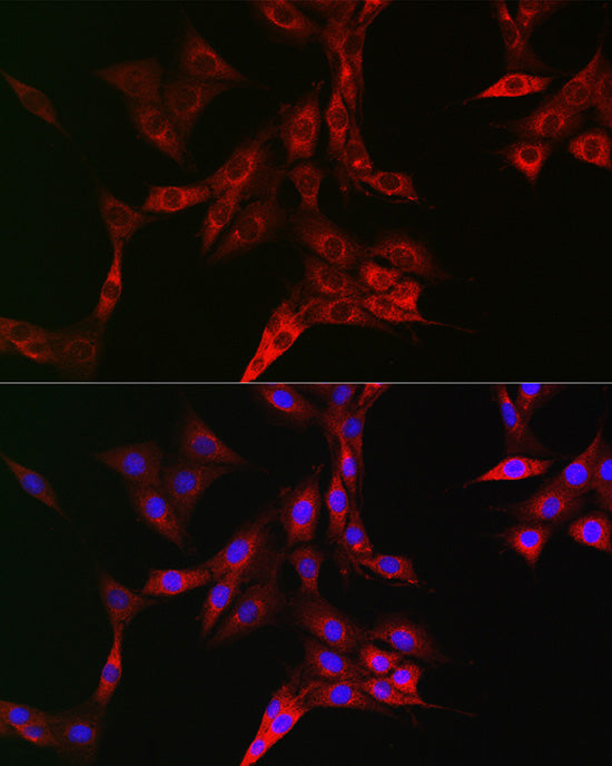 CD71/Transferrin Receptor Rabbit pAb