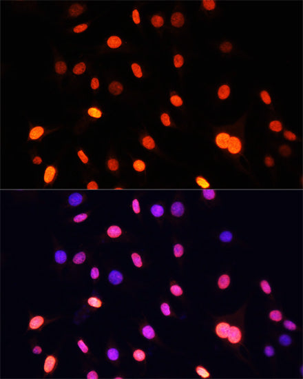 Pan DiMethyl-lysine Rabbit pAb