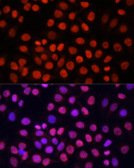 Pan DiMethyl-lysine Rabbit pAb
