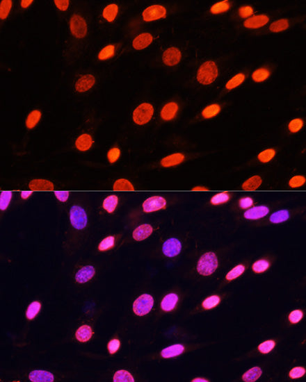 Pan DiMethyl-lysine Rabbit pAb
