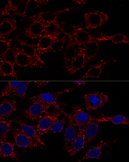 ATP5A1 Rabbit pAb