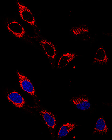 ATP5A1 Rabbit pAb