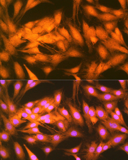 FGF1 Rabbit mAb
