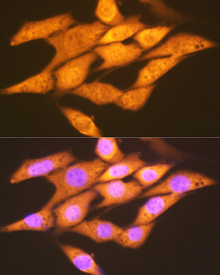 FGF1 Rabbit mAb