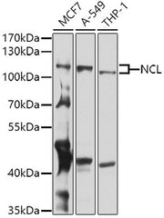 NCL Rabbit pAb