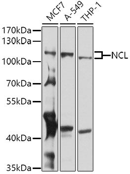 NCL Rabbit pAb