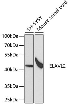 ELAVL2 Rabbit pAb