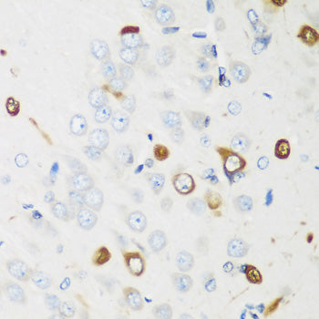 ELAVL2 Rabbit pAb