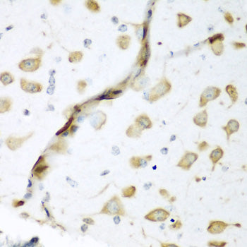 ELAVL2 Rabbit pAb