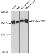 PIK3R4/VPS15 Rabbit mAb